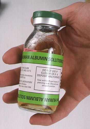آلبومین _ انسانی ( ALBUMIN HUMAN )