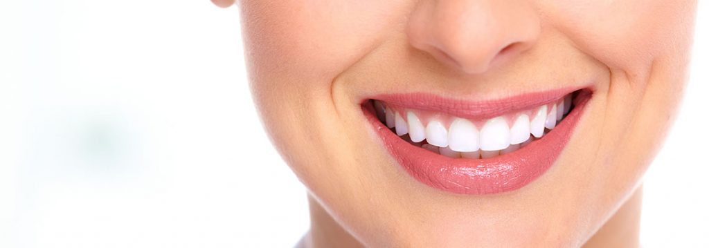 تفاوت لمینت، روکش و ایمپلنت