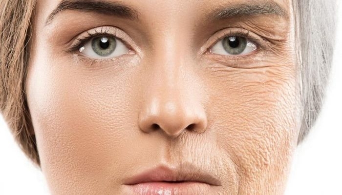 با این روشها چین و چروک صورتتان را کاهش دهید ٬ رفع چین و چروک صورت ٬ درمان چین و چروک های صورت ٬ نحوه درمان چین و چروک ٬ انواع روش های رفع چین و چروک ٬