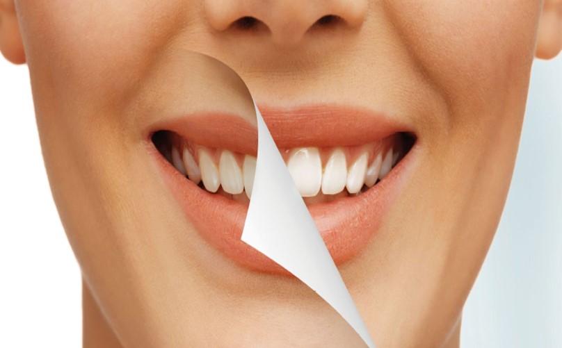 هفت قدم برای داشتن دندان های زیبا تر ٬ روشهای داشتن لبخند زیبا ٬ آموزش سلامت دهان و دندان ٬ آموزش بهداشت دهان و دندان ٬ هفت قدم برای داشتن دندان های زیبا تر ٬ روشهای داشتن لبخند زیبا ٬ آموزش سلامت دهان و دندان ٬ آموزش بهداشت دهان و دندان ٬