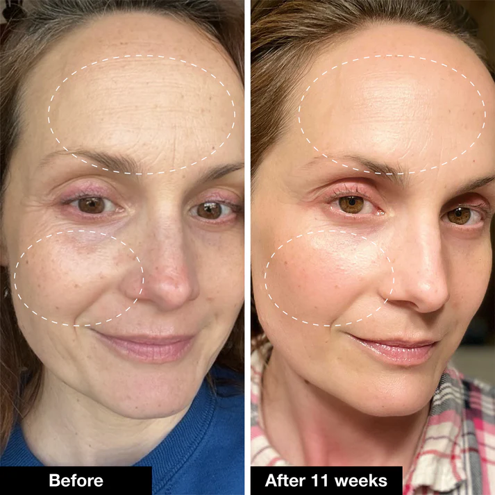 Retinol Serum