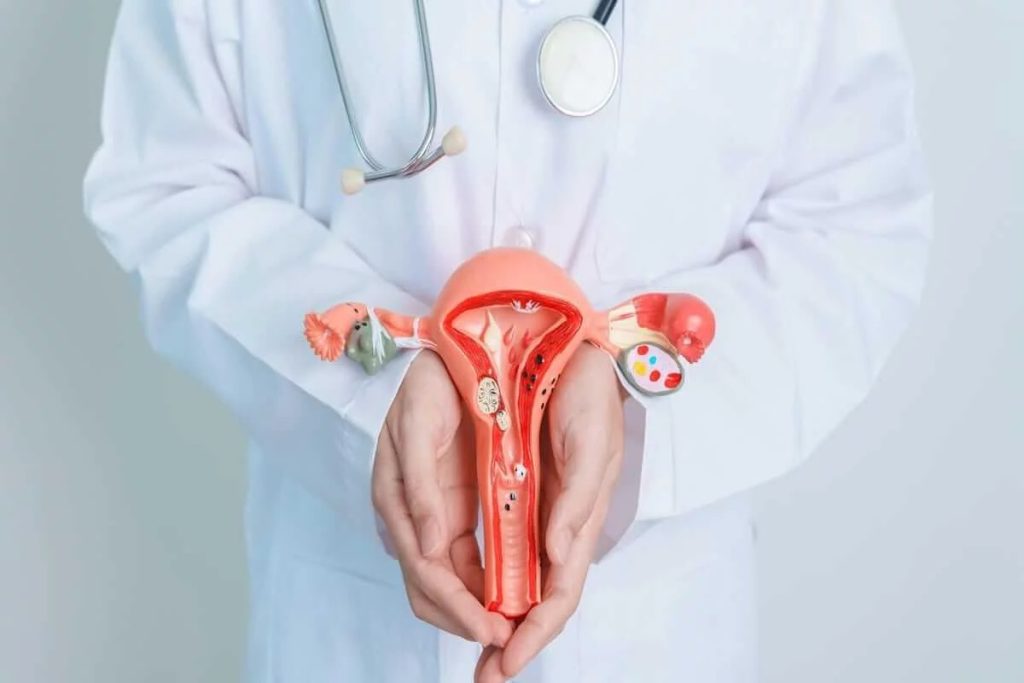Polycystic ovary syndrome