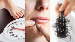 Symptoms of polycystic ovary syndrome